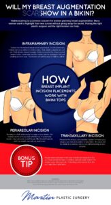 Will My Breast Augmentation Scars Show in a Bikini? [Infographic]