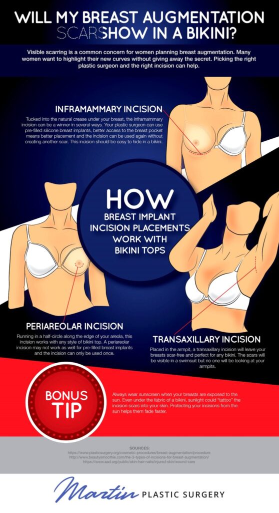 Will My Breast Augmentation Scars Show in a Bikini? [Infographic] img 1