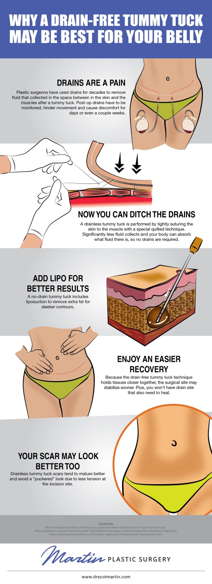 Why A Drain-Free Tummy Tuck May Be Best For Your Belly [Infographic] img 1
