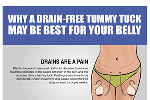 Why A Drain-Free Tummy Tuck May Be Best For Your Belly [Infographic]