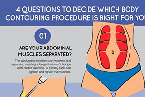 4 Questions to Decide Which Body Contouring Procedure Is Right for You
