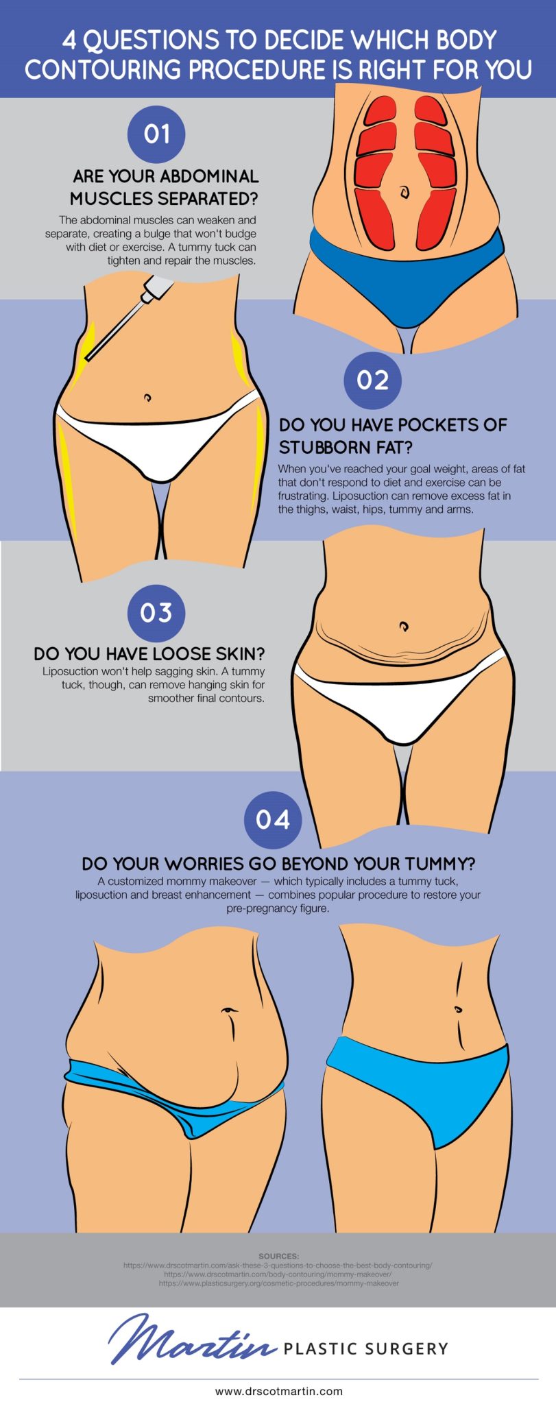 4 Questions to Decide Which Body Contouring Procedure Is Right for You [Infographic] img 1