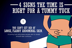 4 Signs the Time Is Right for a Tummy Tuck