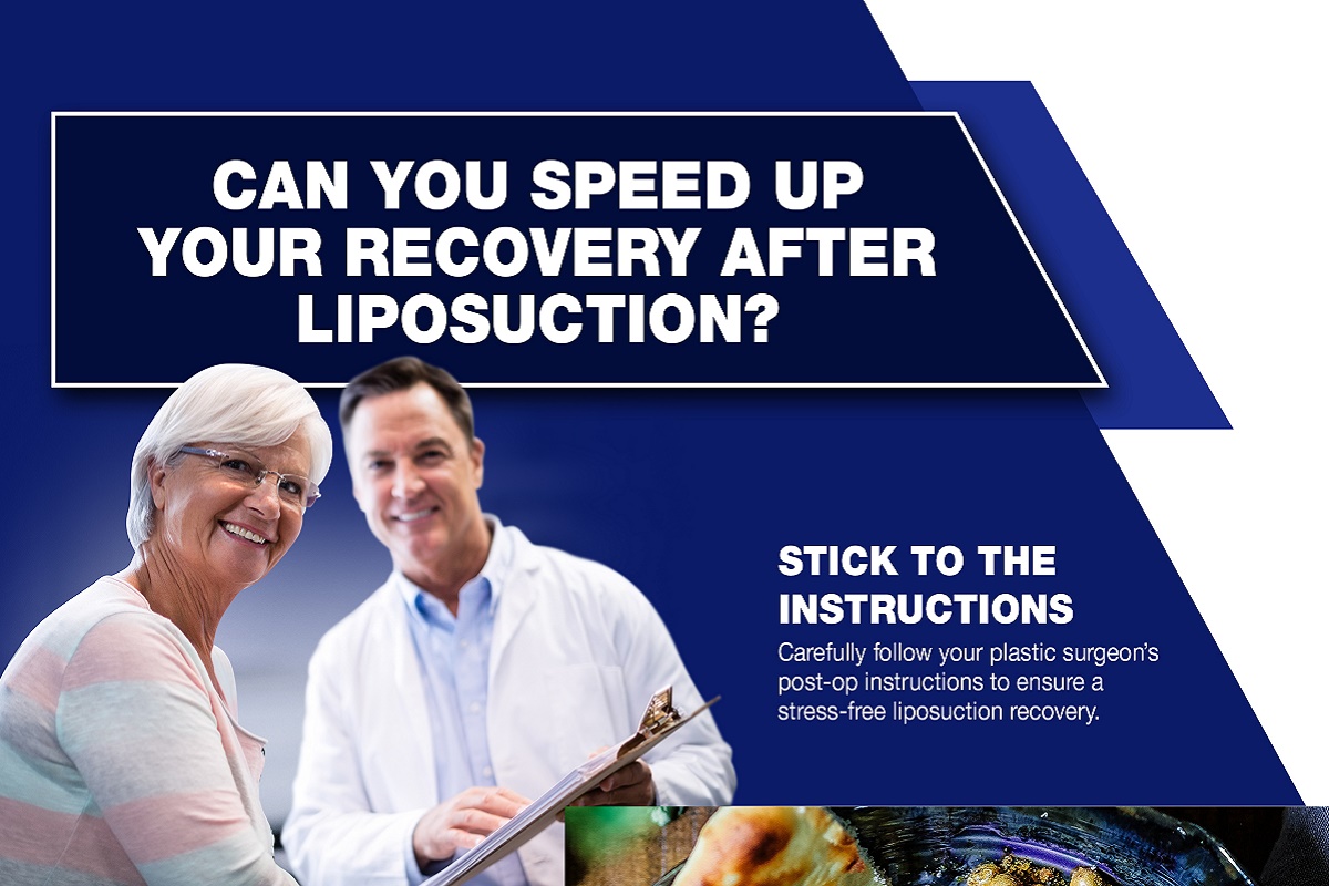 Can You Speed Up Your Recovery After Liposuction? [Infographic]