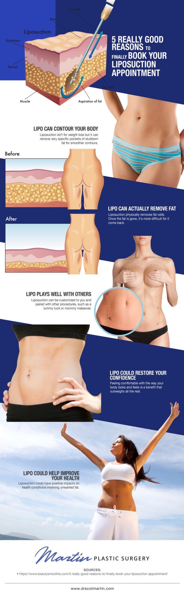 5 Really Good Reasons to Finally Book Your Liposuction Appointment  [Infographic] img 1