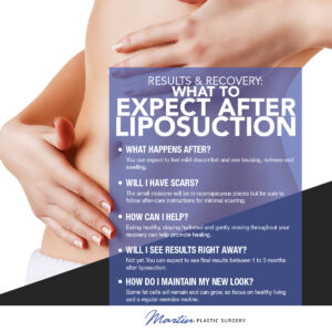 Results & Recovery: What To Expect After Liposuction [Infographic]