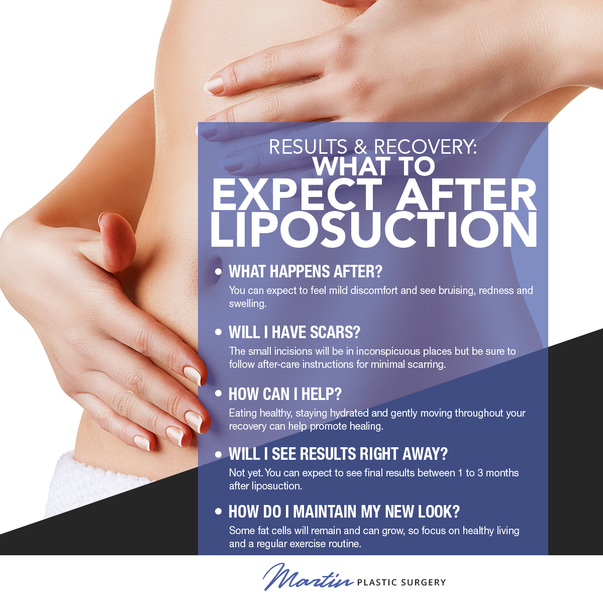 Results & Recovery: What To Expect After Liposuction [Infographic] img 1