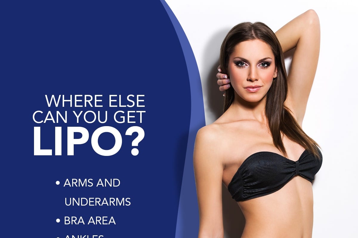Where Else Can You Get Lipo? [Infographic]