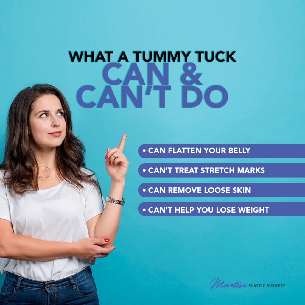 What A Tummy Tuck Can & Can't Do [Infographic] img 1