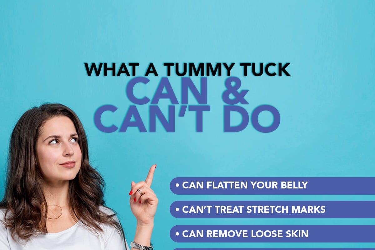 What A Tummy Tuck Can & Can't Do [Infographic]