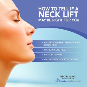How To Tell If A Neck Lift May Be Right For You [Infographic]