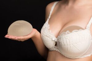 Martin - Silicone implants on hand and natural breast