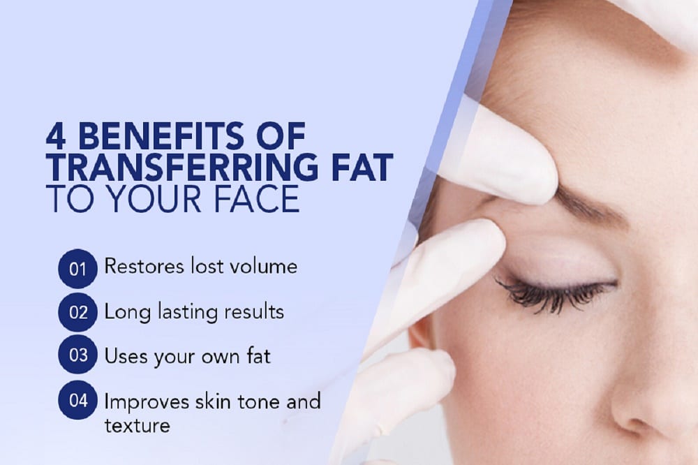 4 Benefits Of Transferring Fat To Your Face [Infographic]