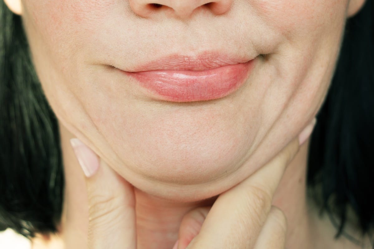 3 Options to Better Define Your Chin