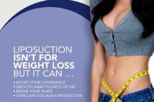 Martin - Infographic july2021 - Liposuction