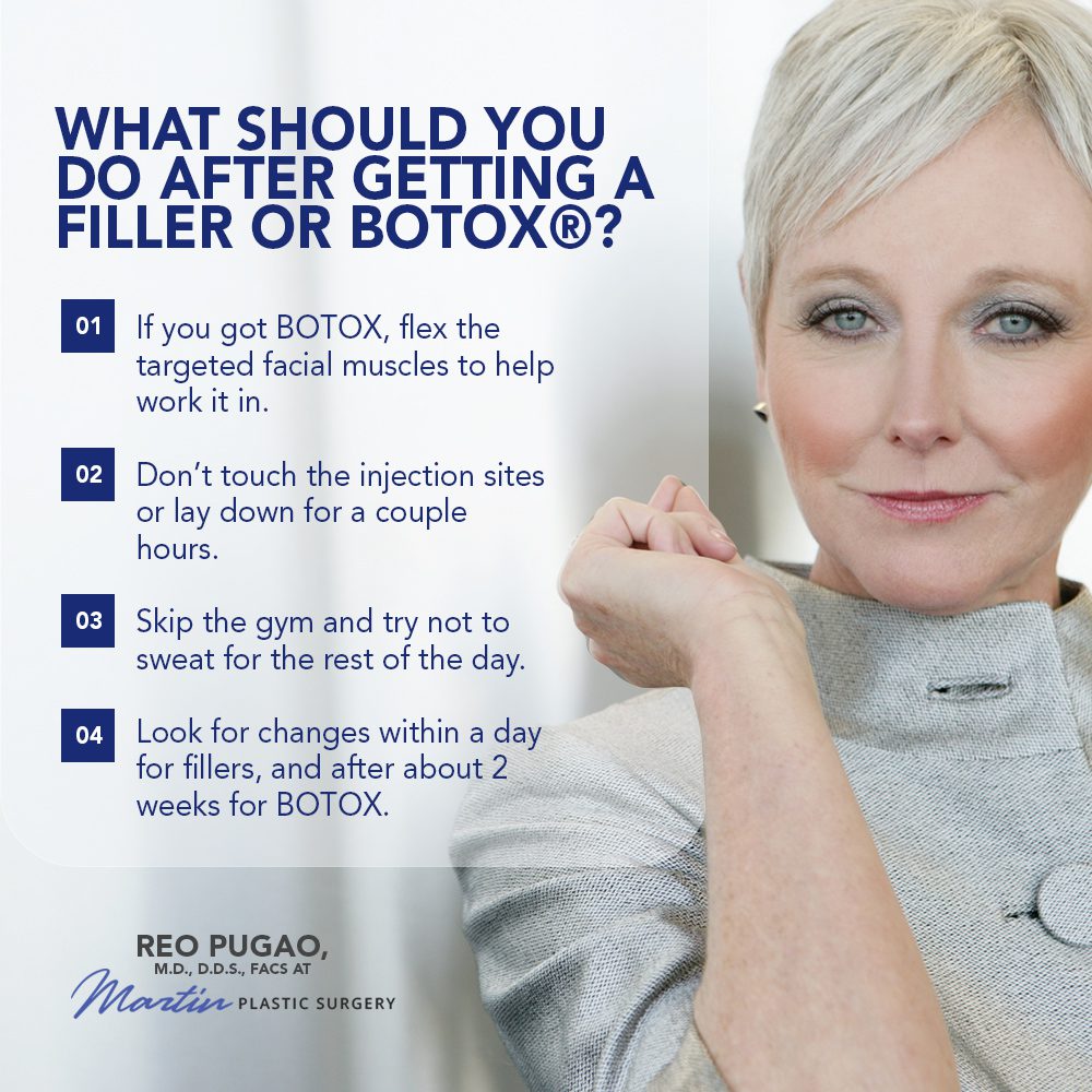 What Should You Do After Getting A Filler Or Botox®?