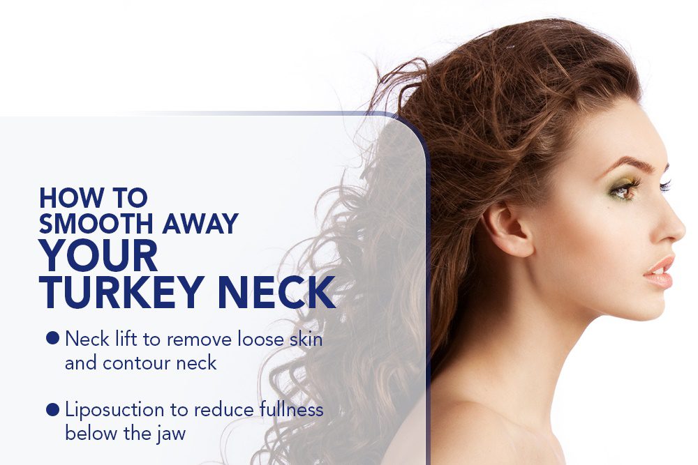How To Smooth Away Your Turkey Neck [Infographic]