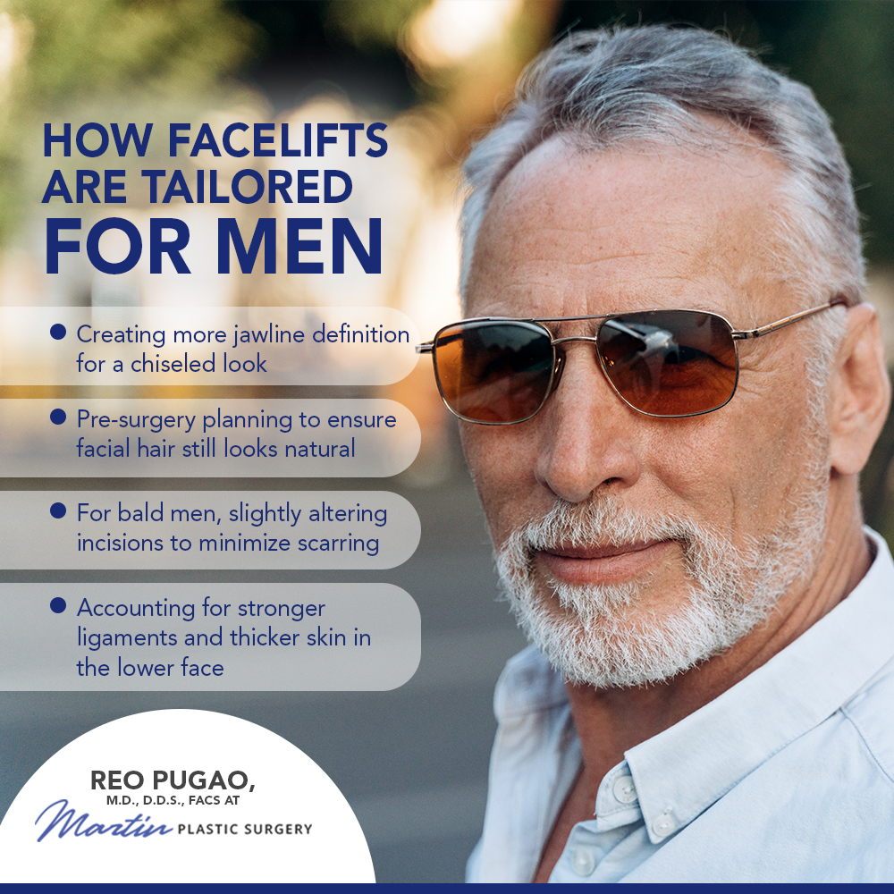 How Facelifts Are Tailored for Men infographic