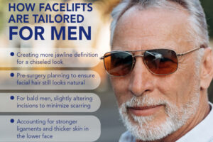 Facelifts Are Tailored for Men infographic