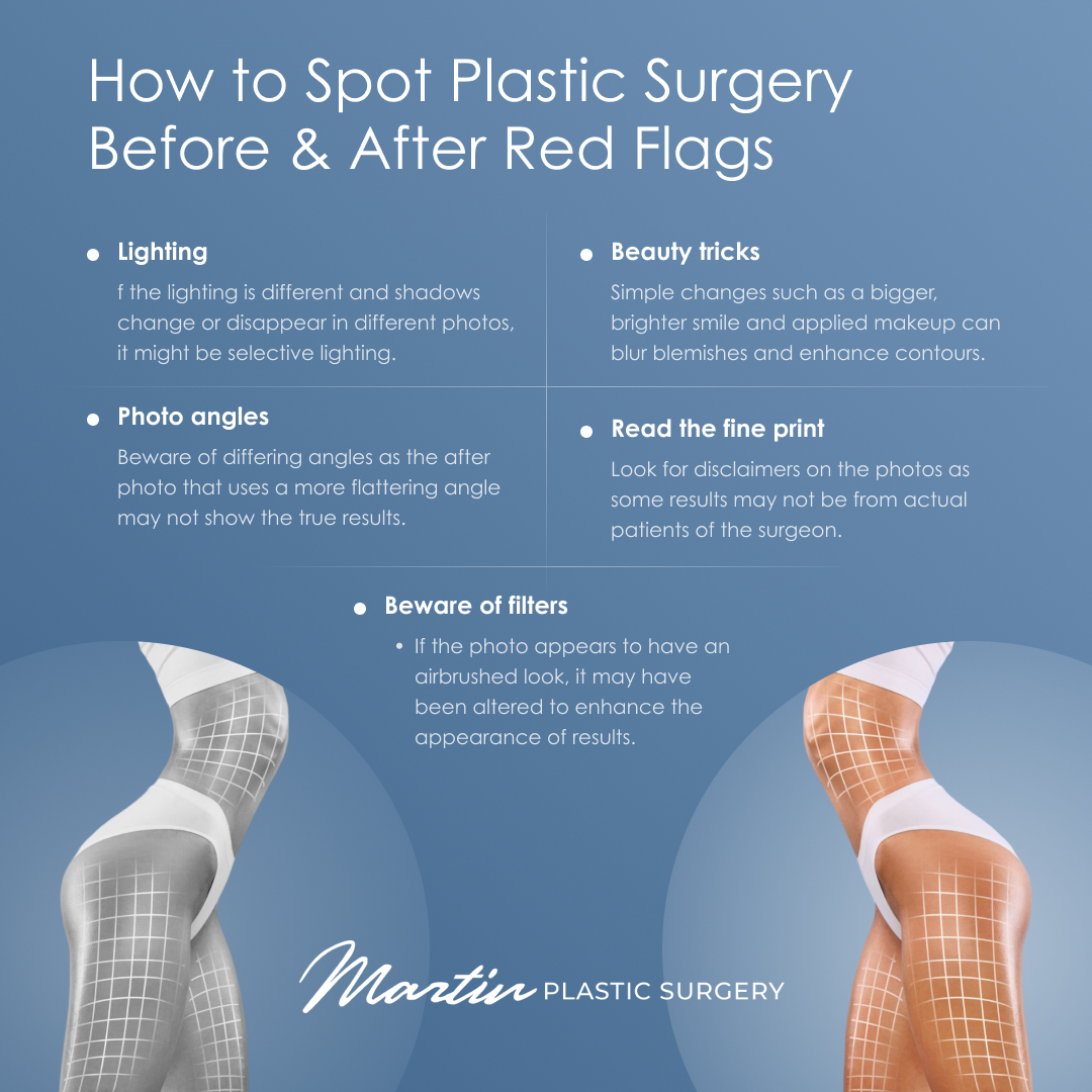 How to Spot Plastic Surgery Before & After Red Flags
