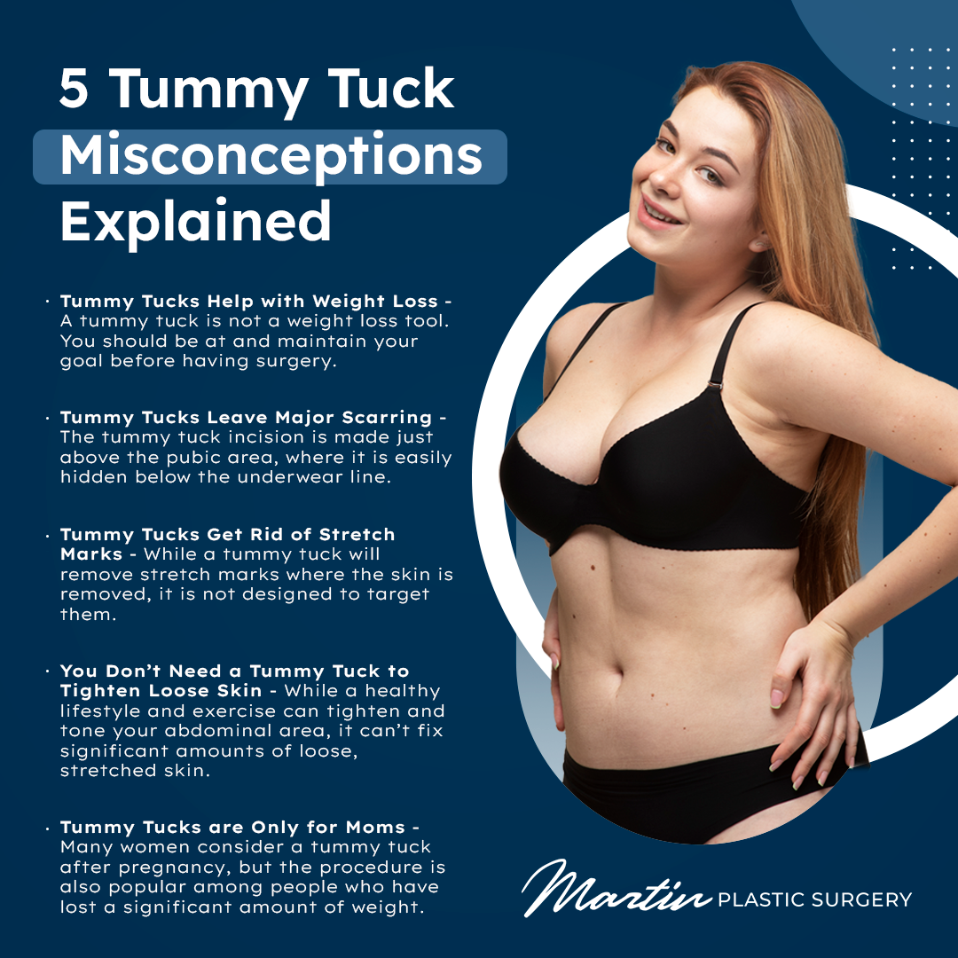 5 Tummy Tuck Misconceptions Explained